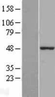 Western Blot: Z DNA binding protein Overexpression Lysate (Adult Normal) [NBL1-17961] Left-Empty vector transfected control cell lysate (HEK293 cell lysate); Right -Over-expression Lysate for Z DNA binding protein.