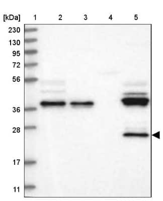 Western Blot ZA20D3 Antibody