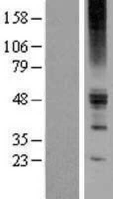 Western Blot ZACN Overexpression Lysate