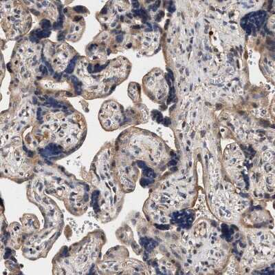 Immunohistochemistry-Paraffin: ZADH2 Antibody [NBP1-82679] - Staining of human placenta shows moderate granular cytoplasmic positivity in trophoblastic cells.