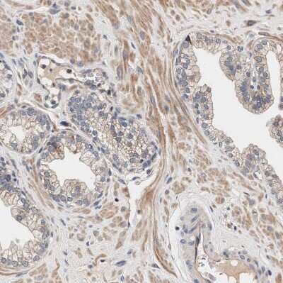 Immunohistochemistry-Paraffin: ZADH2 Antibody [NBP1-82679] - Staining of human prostate shows moderate cytoplasmic positivity in smooth muscle cells.