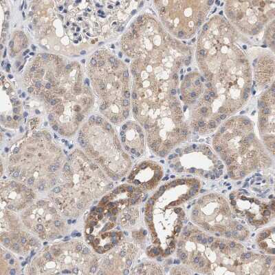 Immunohistochemistry-Paraffin: ZADH2 Antibody [NBP1-82679] - Staining of human kidney shows weak to moderate granular cytoplasmic positivity in cells in tubules.
