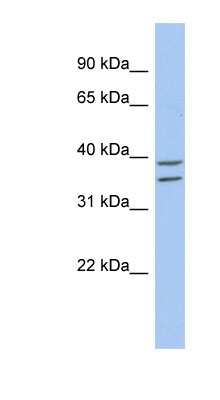 Western Blot: ZADH2 Antibody [NBP1-56952] - 721_B cell lysate, concentration 0.2-1 ug/ml.