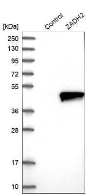 Western Blot ZADH2 Antibody - BSA Free