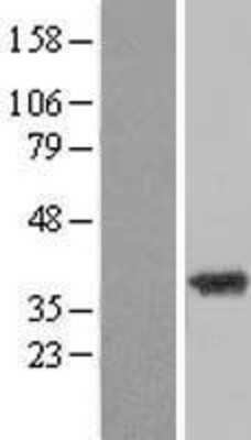 Western Blot: ZADH2 Overexpression Lysate (Adult Normal) [NBL1-17955] Left-Empty vector transfected control cell lysate (HEK293 cell lysate); Right -Over-expression Lysate for ZADH2.