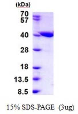 SDS-PAGE Recombinant Human ZADH2 His Protein