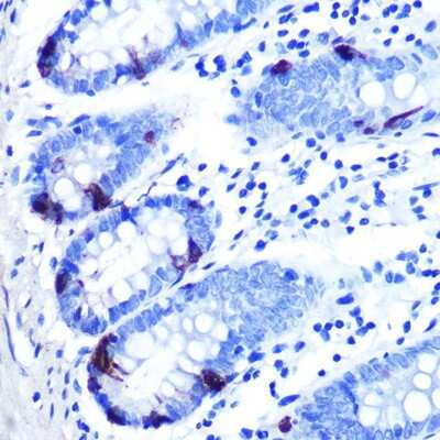 Immunohistochemistry-Paraffin: ZAG Antibody (7I8N3) [NBP3-15426] - Immunohistochemistry of paraffin-embedded human colon carcinoma using ZAG Rabbit mAb (NBP3-15426) at dilution of 1:100 (40x lens).Perform microwave antigen retrieval with 10 mM PBS buffer pH 7.2 before commencing with IHC staining protocol.