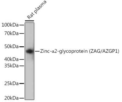 Western Blot: ZAG Antibody (7I8N3) [NBP3-15426] - Western blot analysis of extracts of Rat plasma, using ZAG Rabbit mAb (NBP3-15426) at 1:1000 dilution. Secondary antibody: HRP Goat Anti-Rabbit IgG (H+L) at 1:10000 dilution. Lysates/proteins: 25ug per lane. Blocking buffer: 3% nonfat dry milk in TBST. Detection: ECL Basic Kit. Exposure time: 3min.