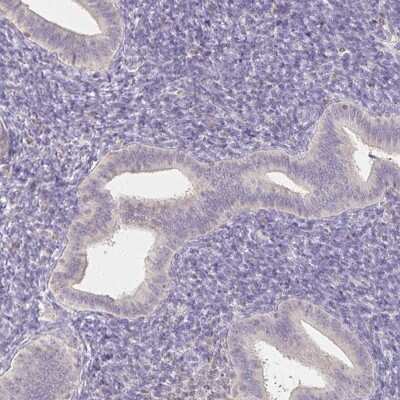 <b>Orthogonal Strategies Validation. </b>Immunohistochemistry-Paraffin: ZAG Antibody [NBP1-86842] - Staining of human endometrium shows low expression as expected.