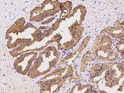 Immunohistochemistry-Paraffin: ZAG Antibody [NBP2-97955] - Immunochemical staining of human ZAG in human breast with rabbit polyclonal antibody at 1:1000 dilution, formalin-fixed paraffin embedded sections.
