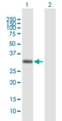 Western Blot: ZAG Antibody [H00000563-B01P] - Analysis of AZGP1 expression in transfected 293T cell line by AZGP1 polyclonal antibody.  Lane 1: AZGP1 transfected lysate(32.89 KDa). Lane 2: Non-transfected lysate.