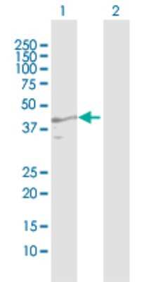 Western Blot: ZAG Antibody [H00000563-D01P] - Analysis of AZGP1 expression in transfected 293T cell line by AZGP1 polyclonal antibody.Lane 1: AZGP1 transfected lysate(34.30 KDa).Lane 2: Non-transfected lysate.