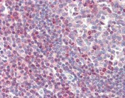 Immunohistochemistry: ZAP70 Antibody (11H40) [NBP1-19190] - Human tonsil tissue stained with Zap-70, mAb (11H40) at 20ug/ml.