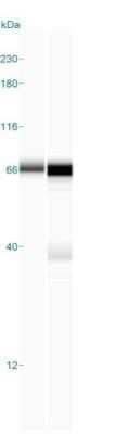 Simple Western: ZAP70 Antibody (2F3.2) - Azide and BSA Free [NBP2-47774] - Simple Western lane view shows a specific band for ZAP70 in 0.2 mg/ml of Jurkat (left) and H. Tonsil (right) lysate(s). This experiment was performed under reducing conditions using the 12-230 kDa separation system.