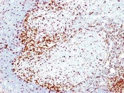 Immunohistochemistry-Paraffin: ZAP70 Antibody (2F3.2) - IHC-Prediluted [NBP2-48224] - Formalin-fixed, paraffin-embedded human Tonsil stained with ZAP70 Mouse Monoclonal Antibody (2F3.2)