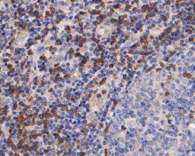 Immunohistochemistry-Paraffin: ZAP70 Antibody (A1B5) [NBP2-89121] - Analysis of paraffin-embedded human tonsil tissue using anti-ZAP70 antibody. The section was pre-treated using heat mediated antigen retrieval with Tris-EDTA buffer (pH 8.0-8.4) for 20 minutes.The tissues were blocked in 5% BSA for 30 minutes at room temperature, washed with ddH2O and PBS, and then probed with the primary antibody( 1/50) for 30 minutes at room temperature. The detection was performed using an HRP conjugated compact polymer system. DAB was used as the chromogen. Tissues were counterstained with hematoxylin and mounted with DPX.