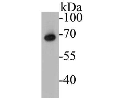 Western Blot: ZAP70 Antibody (A1B5) [NBP2-89121] - Analysis of ZAP70 on Jurkat cell lysate. Proteins were transferred to a PVDF membrane and blocked with 5% BSA in PBS for 1 hour at room temperature. The primary antibody( 1/500) was used in 5% BSA at room temperature for 2 hours. Goat Anti-Mouse IgG - HRP Secondary Antibody at 1:5,000 dilution was used for 1 hour at room temperature.