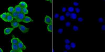 Immunocytochemistry/Immunofluorescence: ZAP70 Antibody (JU08-39) [NBP2-75719] - Staining ZAP70 in LOVO cells (green). The nuclear counter stain is DAPI (blue). Cells were fixed in paraformaldehyde, permeabilised with 0.25% Triton X100/PBS.