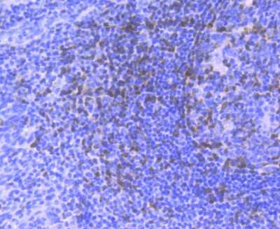 Immunohistochemistry-Paraffin: ZAP70 Antibody (JU08-39) [NBP2-75719] - Analysis of paraffin-embedded human tonsil tissue using anti-ZAP70 antibody. Counter stained with hematoxylin.