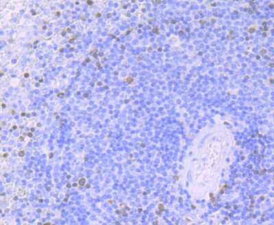 Immunohistochemistry-Paraffin: ZAP70 Antibody (JU08-39) [NBP2-75719] - Analysis of paraffin-embedded human spleen tissue using anti-ZAP70 antibody. Counter stained with hematoxylin.