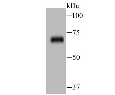 Western Blot: ZAP70 Antibody (JU08-39) [NBP2-75719] - Analysis of ZAP70 on human thymus tissue lysate using anti-ZAP70 antibody at 1/500 dilution.