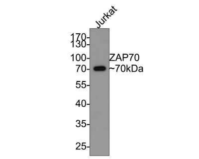 Western Blot: ZAP70 Antibody (JU08-39) [NBP2-75719] - Analysis of ZAP70 on Jurkat cell lysates with Rabbit anti-ZAP70 antibody at 1/500 dilution. Lysates/proteins at 10 ug/Lane. Predicted band size: 70 kDa Observed band size: 70 kDa Exposure time: 30 seconds; 10% SDS-PAGE gel. Proteins were transferred to a PVDF membrane and blocked with 5% NFDM/TBST for 1 hour at room temperature. The primary antibody at 1/500 dilution was used in 5% NFDM/TBST at room temperature for 2 hours. Goat Anti-Rabbit IgG - HRP Secondary Antibody at 1:200,000 dilution was used for 1 hour at room temperature.