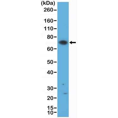 Western Blot: ZAP70 Antibody (RM408) [NBP2-89104] - Western Blot of Jurkat cell lysate using Anti-ZAP70 rabbit monoclonal antibody (Clone RM408) at a 1:500 dilution.