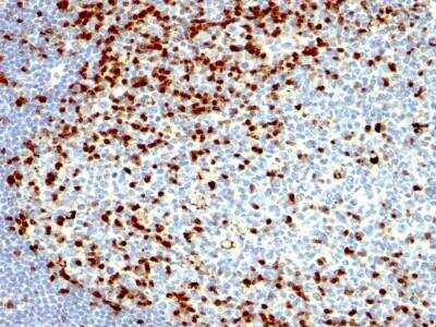 Immunohistochemistry-Paraffin: ZAP70 Antibody (SPM362) - IHC-Prediluted [NBP2-48250] - Formalin-fixed, paraffin-embedded human Tonsil stained with ZAP70 Mouse Monoclonal Antibody (SPM362).