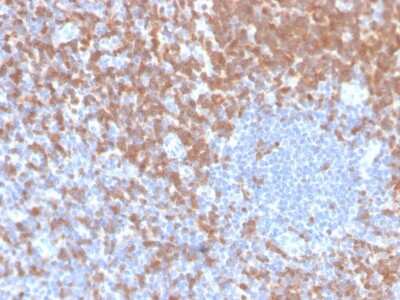 Immunohistochemistry-Paraffin: ZAP70 Antibody (ZAP70/4040R) - Azide and BSA Free [NBP3-08968] - Formalin-fixed, paraffin-embedded human tonsil stained with ZAP70 Recombinant Rabbit Monoclonal Antibody (ZAP70/4040R).