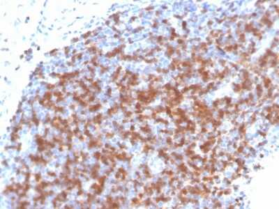 Immunohistochemistry-Paraffin: ZAP70 Antibody (ZAP70/4040R) - Azide and BSA Free [NBP3-08968] - Formalin-fixed, paraffin-embedded human tonsil stained with ZAP70 Recombinant Rabbit Monoclonal Antibody (ZAP70/4040R).