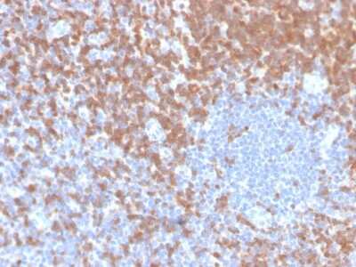 Immunohistochemistry-Paraffin: ZAP70 Antibody (ZAP70/4040R) [NBP3-07223] - Formalin-fixed, paraffin-embedded human tonsil stained with ZAP70 Recombinant Rabbit Monoclonal Antibody (ZAP70/4040R).