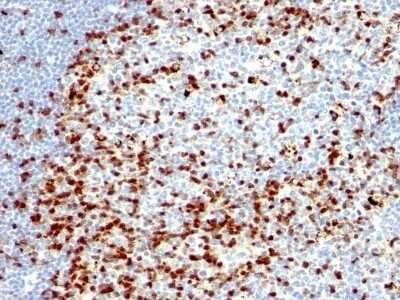 Immunohistochemistry-Paraffin: ZAP70 Antibody (ZAP70/528 + 2F3.2) - Azide and BSA Free [NBP2-47775] - Human Tonsil stained with ZAP70 Monoclonal Antibody (ZAP70/528 + 2F3.2).