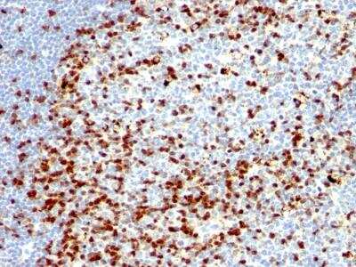 Immunohistochemistry-Paraffin: ZAP70 Antibody (ZAP70/528 + 2F3.2) - IHC-Prediluted [NBP2-48272] - Human Tonsil stained with ZAP70 Mouse Monoclonal Antibody (ZAP70/528 + 2F3.2).