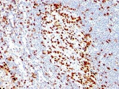 Immunohistochemistry-Paraffin: ZAP70 Antibody (ZAP70/528) - IHC-Prediluted [NBP2-48251] - Formalin-fixed, paraffin-embedded human Tonsil stained with ZAP70 Mouse Monoclonal Antibody (ZAP70/528).