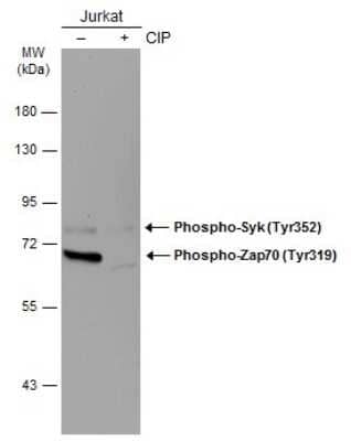 <b>Biological Strategies Validation. </b>Western Blot: ZAP70 [p Tyr352] Antibody (GT364) [NBP3-13621] - Untreated (-) and treated (+) Jurkat whole cell extracts (30 ug) were separated by 7.5% SDS-PAGE, and the membrane was blotted with Zap70 (phospho Tyr319) + Syk (phospho Tyr352) antibody [GT364] (NBP3-13621) diluted at 1:1000. The HRP-conjugated anti-mouse IgG antibody (NBP2-19382) was used to detect the primary antibody.