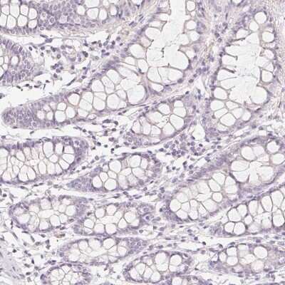 Immunohistochemistry-Paraffin: ZBBX Antibody [NBP1-82092] - Staining of human colon shows low expression as expected.