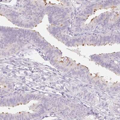 Immunohistochemistry-Paraffin: ZBBX Antibody [NBP1-82092] - Staining of human fallopian tube shows high expression.