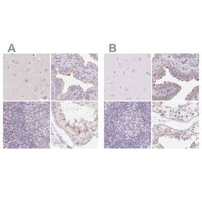 Immunohistochemistry-Paraffin: ZBBX Antibody [NBP1-82092] - Staining of human cerebral cortex, fallopian tube, lymph node and testis using Anti-ZBBX antibody NBP1-82092 (A) shows similar protein distribution across tissues to independent antibody NBP2-38294 (B).