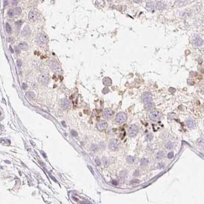 Immunohistochemistry-Paraffin: ZBBX Antibody [NBP1-82092] - Staining of human testis.