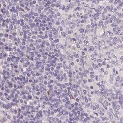 Immunohistochemistry-Paraffin: ZBBX Antibody [NBP1-82092] - Staining of human lymph node.