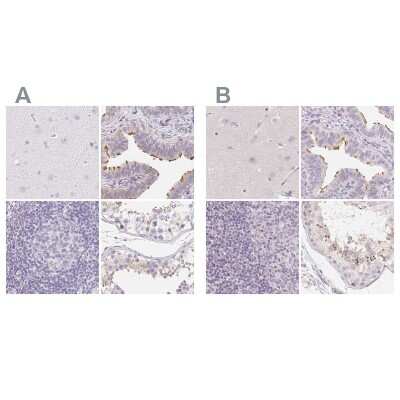 Immunohistochemistry-Paraffin: ZBBX Antibody [NBP2-38294] - Staining of human cerebral cortex, fallopian tube, lymph node and testis using Anti-ZBBX antibody NBP2-38294 (A) shows similar protein distribution across tissues to independent antibody NBP1-82092 (B).