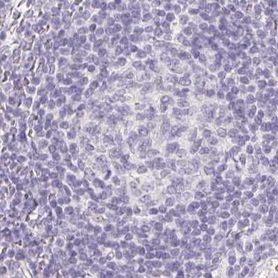 Immunohistochemistry-Paraffin: ZBBX Antibody [NBP2-38294] - Staining of human lymph node.
