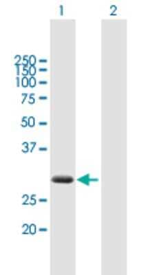 Western Blot ZBED2 Antibody - Azide and BSA Free