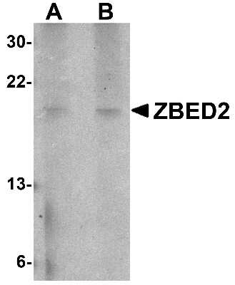 Western Blot ZBED2 Antibody - BSA Free