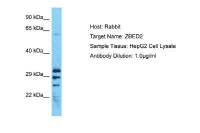 Western Blot ZBED2 Antibody - BSA Free