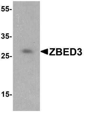 Western Blot: ZBED3 Antibody [NBP1-77348] - Analysis of ZBED3 in Jurkat cell lysate with ZBED3 antibody at 1 ug/ml.