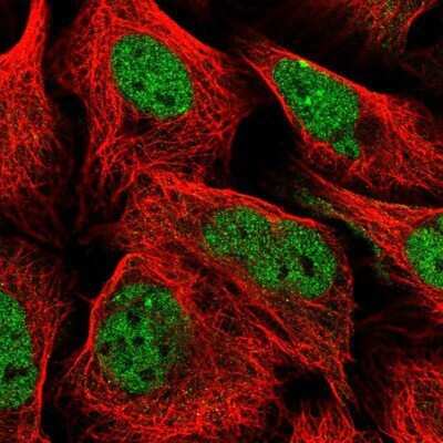 Immunocytochemistry/ Immunofluorescence ZBED4 Antibody