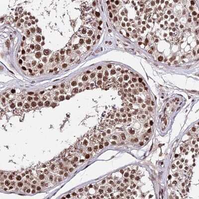 Immunohistochemistry-Paraffin ZBED4 Antibody