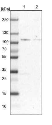 Western Blot: ZBED4 Antibody [NBP2-13531] - Lane 1: NIH-3T3 cell lysate (Mouse embryonic fibroblast cells) Lane 2: NBT-II cell lysate (Rat Wistar bladder tumour cells)