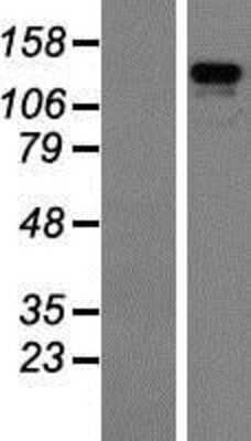 Western Blot: ZBED4 Overexpression Lysate (Adult Normal) [NBP2-07265] Left-Empty vector transfected control cell lysate (HEK293 cell lysate); Right -Over-expression Lysate for ZBED4.